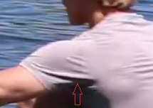 schulter_trampolin1_ausschnitt_bearbeitet.png schulter_trampolin1_ausschnitt_bearbeitet.png